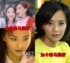 明星整毁容,从颜值巅峰到毁容边缘的惊险历程